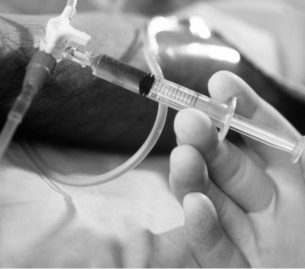 Эвтаназия: за или против?